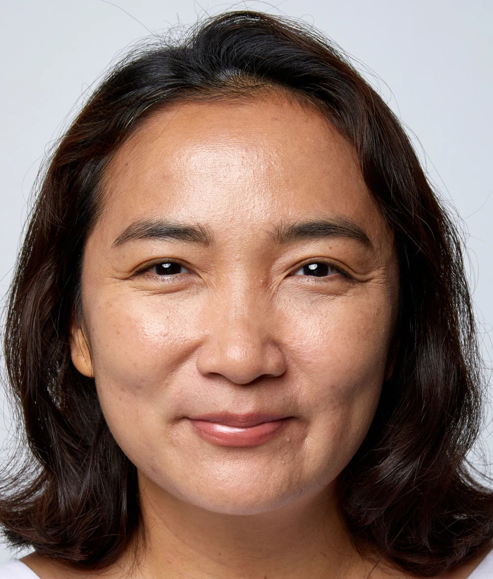 Photo of Selina After Using NAIIAN for 1 Month