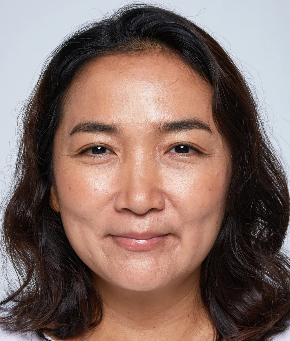 Photo of Selina After Using NAIIAN for 3 Months