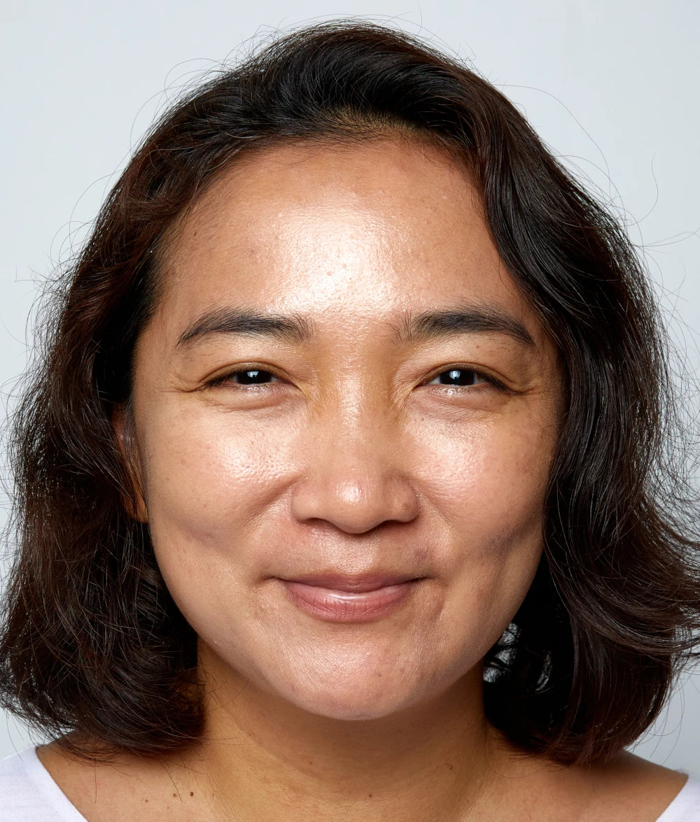 Photo of Selina Before Using NAIIAN
